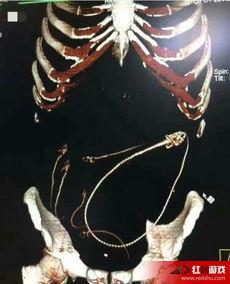 黄鳝门在线观看神马,揭秘网络直播背后的惊悚真相  第3张